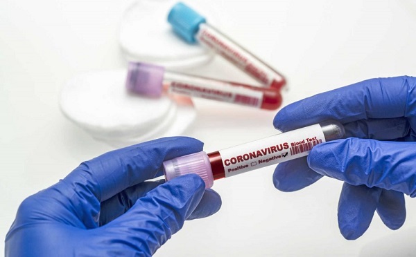 Kiterjesztik a veszélyeztetett munkakörökben dolgozók tesztelését Egerben